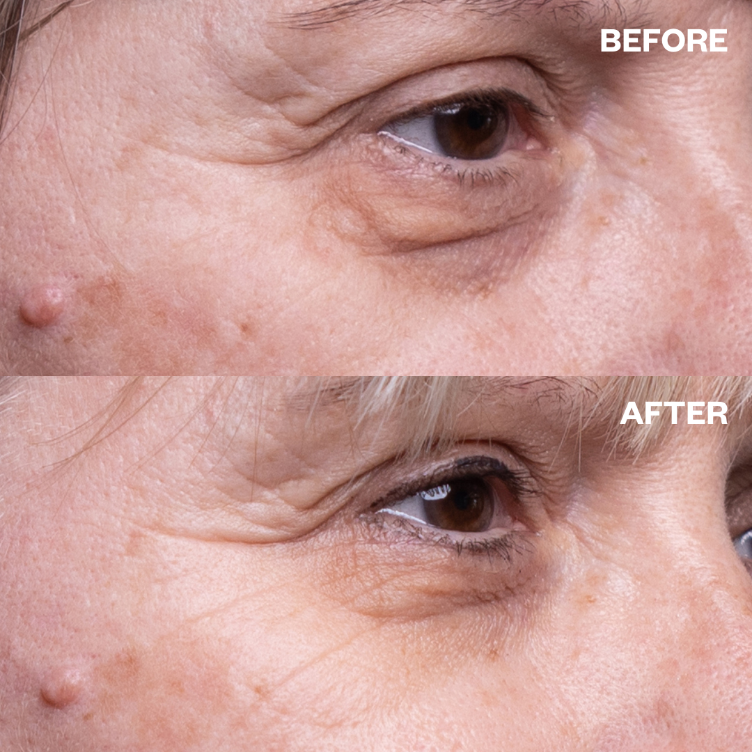Eye Wrinkle Patches - One Pair